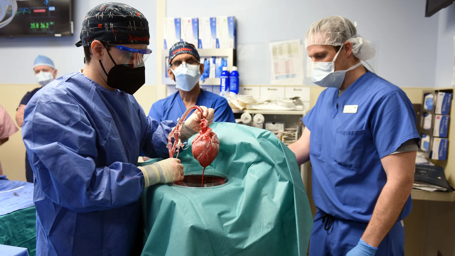 David Bennett recibió este corazón de cerdo gracias al trabajo del equipo del doctor Bartley Griffith