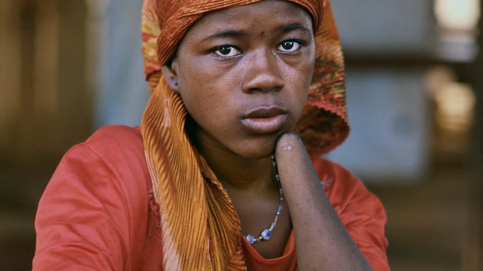 Mariatu Kamara, de 15 años, sufrió en 1999 la amputación de sus dos manos (Freetown, Sierra Leona, enero de 2001)