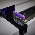 Test genético usado para el análisis de linfocitos T