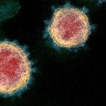 Micrografía de viriones de SARS-CoV-2