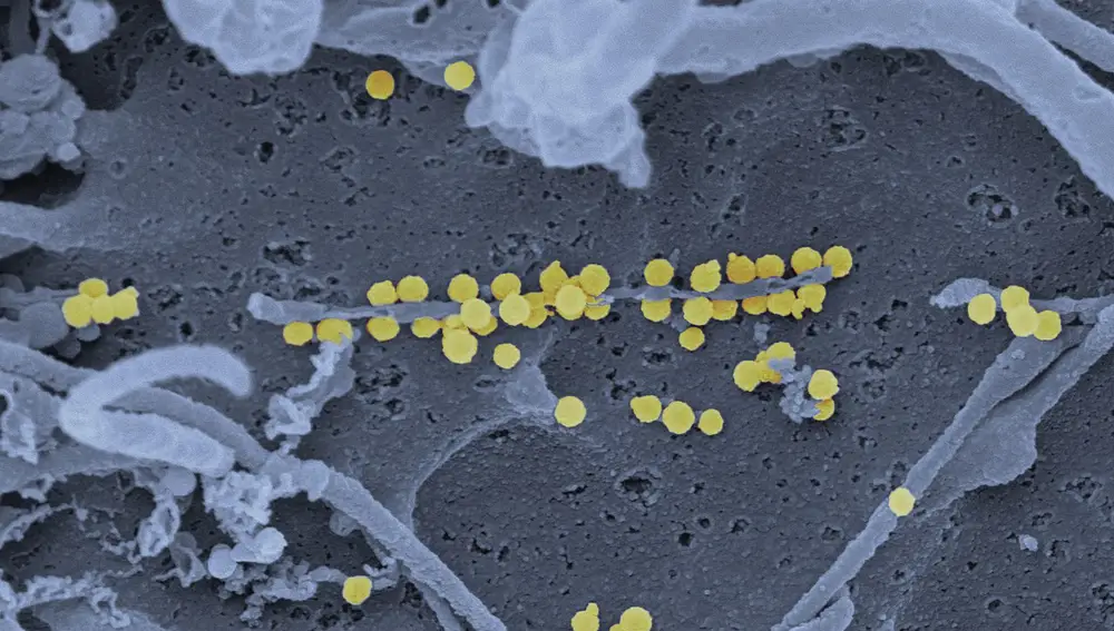 Partículas virales de la fiebre hemorrágica de Crimea-Congo en amarillo