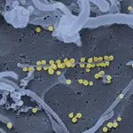 Partículas virales de la fiebre hemorrágica de Crimea-Congo en amarillo