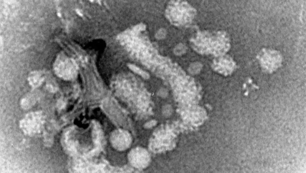 Vista microscópica del Enterovirus D68