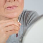 Exceso de vello corporal en mujeres