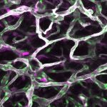 Inmunoflorescencia de tejido adiposo blanco donde se han teñido los vasos sanguíneos en blanco, los núcleos de las células endoteliales en verde y las células que están proliferando en magenta