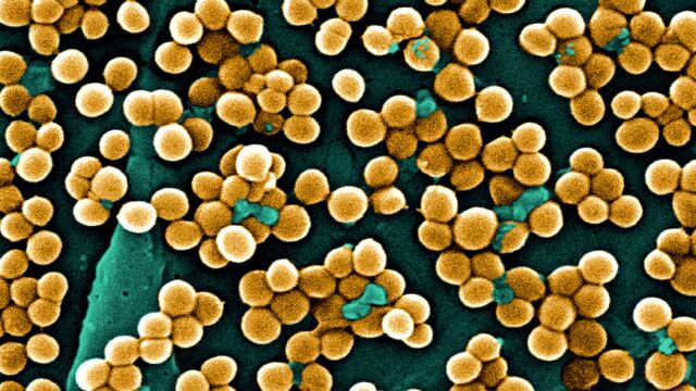 Vista de estafilococo dorado ('Staphylococcus aureus') resistente a meticilina.