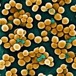 Vista de estafilococo dorado ('Staphylococcus aureus') resistente a meticilina.