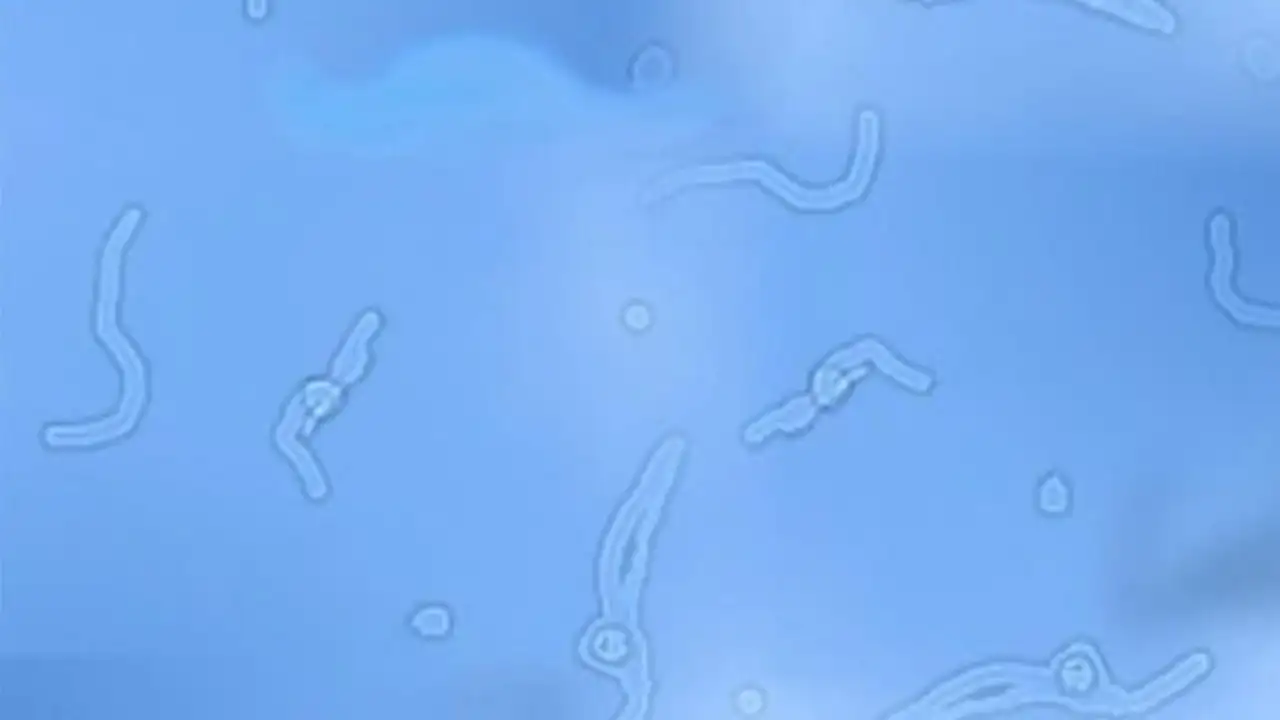 Qué son esas manchas que vemos flotando en nuestros ojos? ¿Qué las causan?