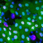 Durante la erebosis, las células van perdiendo distintas proteínas fluorescentes hasta oscurecerse casi por completo.
