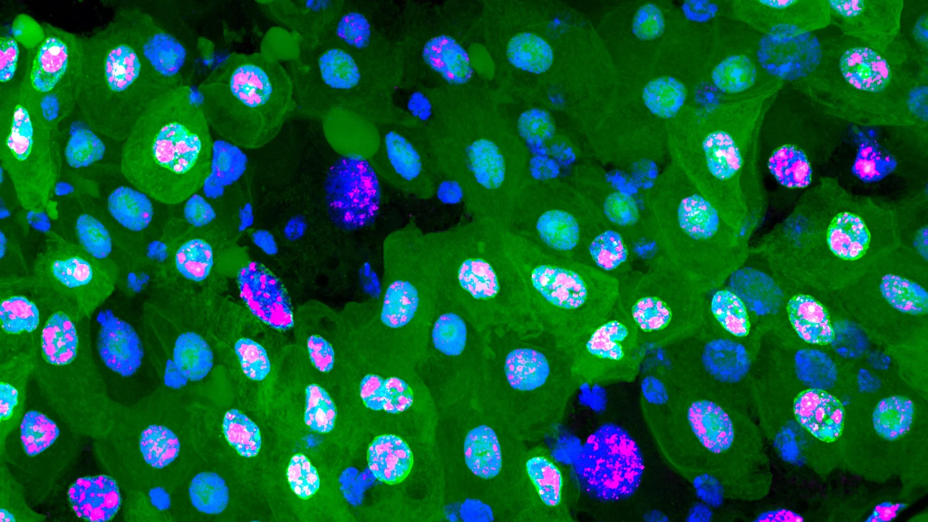 Durante la erebosis, las células van perdiendo distintas proteínas fluorescentes hasta oscurecerse casi por completo.