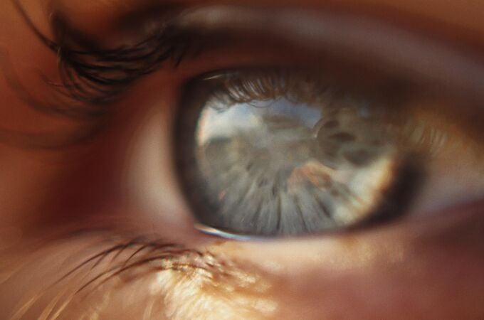 El glaucoma es la segunda causa de ceguera en el mundo.
