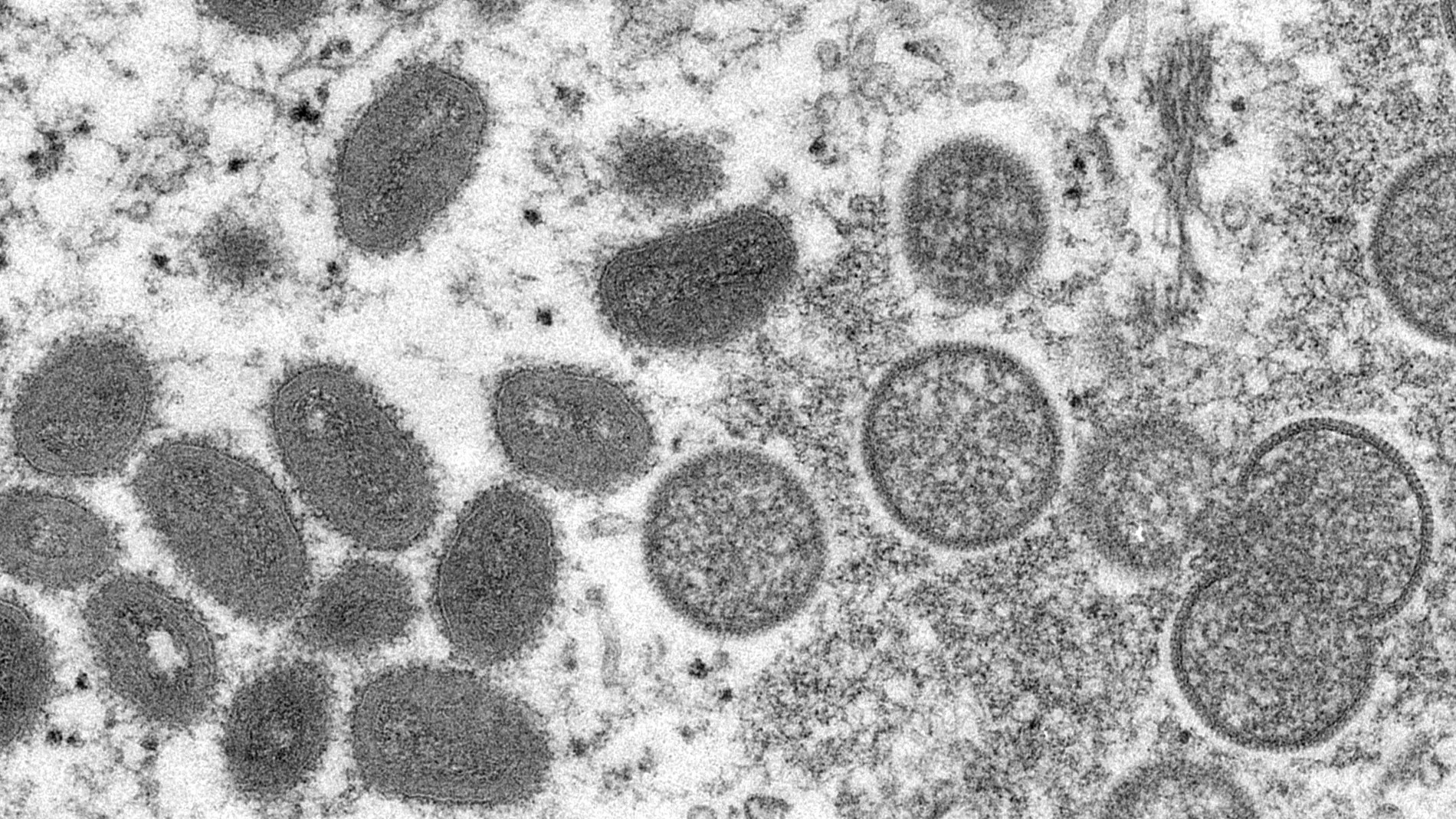 Imagen de microscopio proporcionada por los Centros para el Control y la Prevención de Enfermedades que muestra viriones maduros de viruela del mono