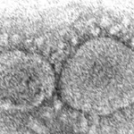 Imagen de microscopio proporcionada por los Centros para el Control y la Prevención de Enfermedades que muestra partículas del virus SARS-CoV-2 que causa la COVID-19