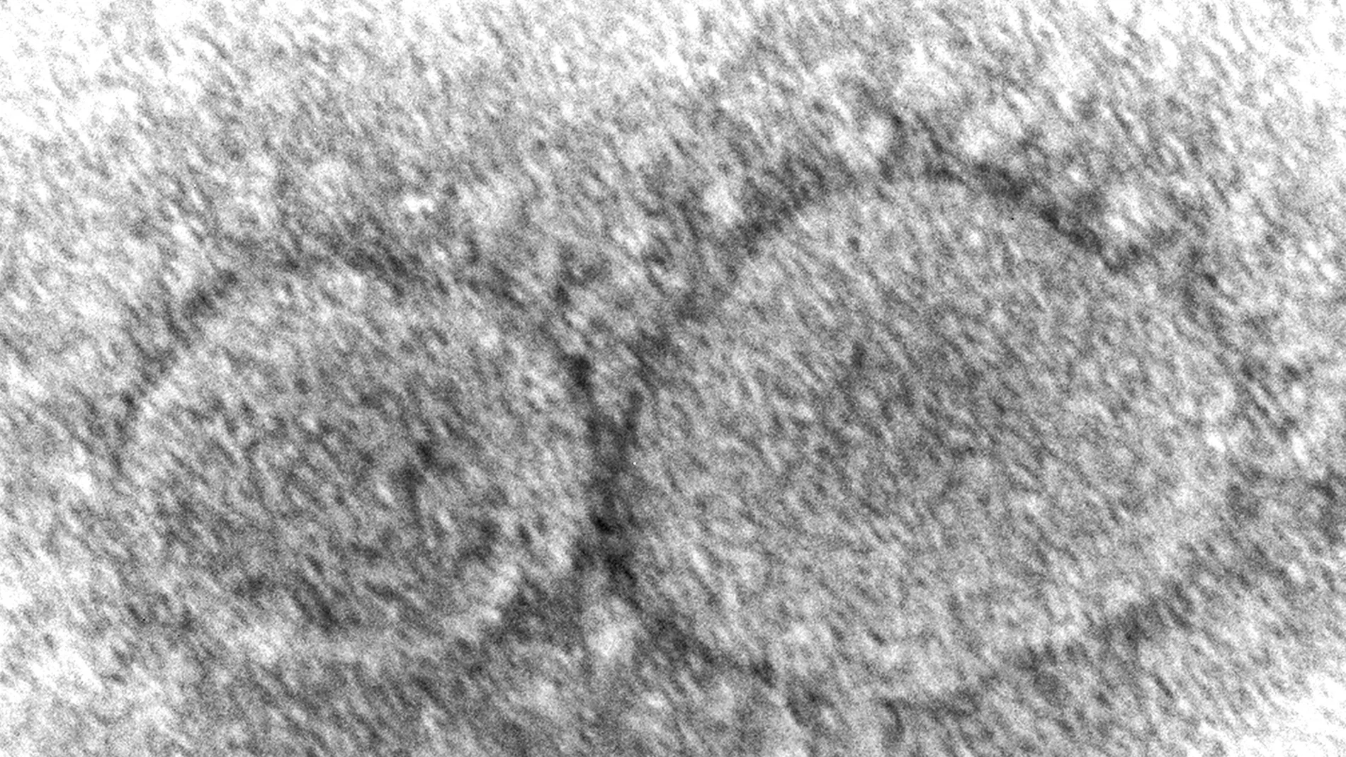 Imagen de microscopio proporcionada por los Centros para el Control y la Prevención de Enfermedades que muestra partículas del virus SARS-CoV-2 que causa la COVID-19