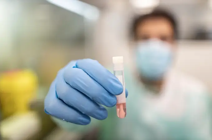 Arranca en Madrid la vacunación preexposición contra la viruela del mono
