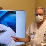 El doctor Burdeus muestra la prótesis de cadera personalizada y adaptada a las particularidades del paciente que ha implantado a un hombre con malformación congénita múltiple