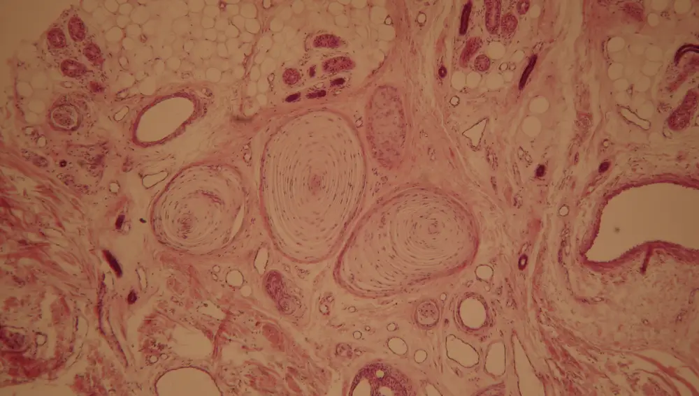 Vista de microscopio del corpúsculo de Pacini