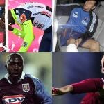 Las lesiones más absurdas del deporte