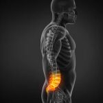 Los dolores de espalda son los más consultados a los médicos de atención primaria