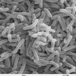 Vibrio cholerae: la bacteria que causa el cólera