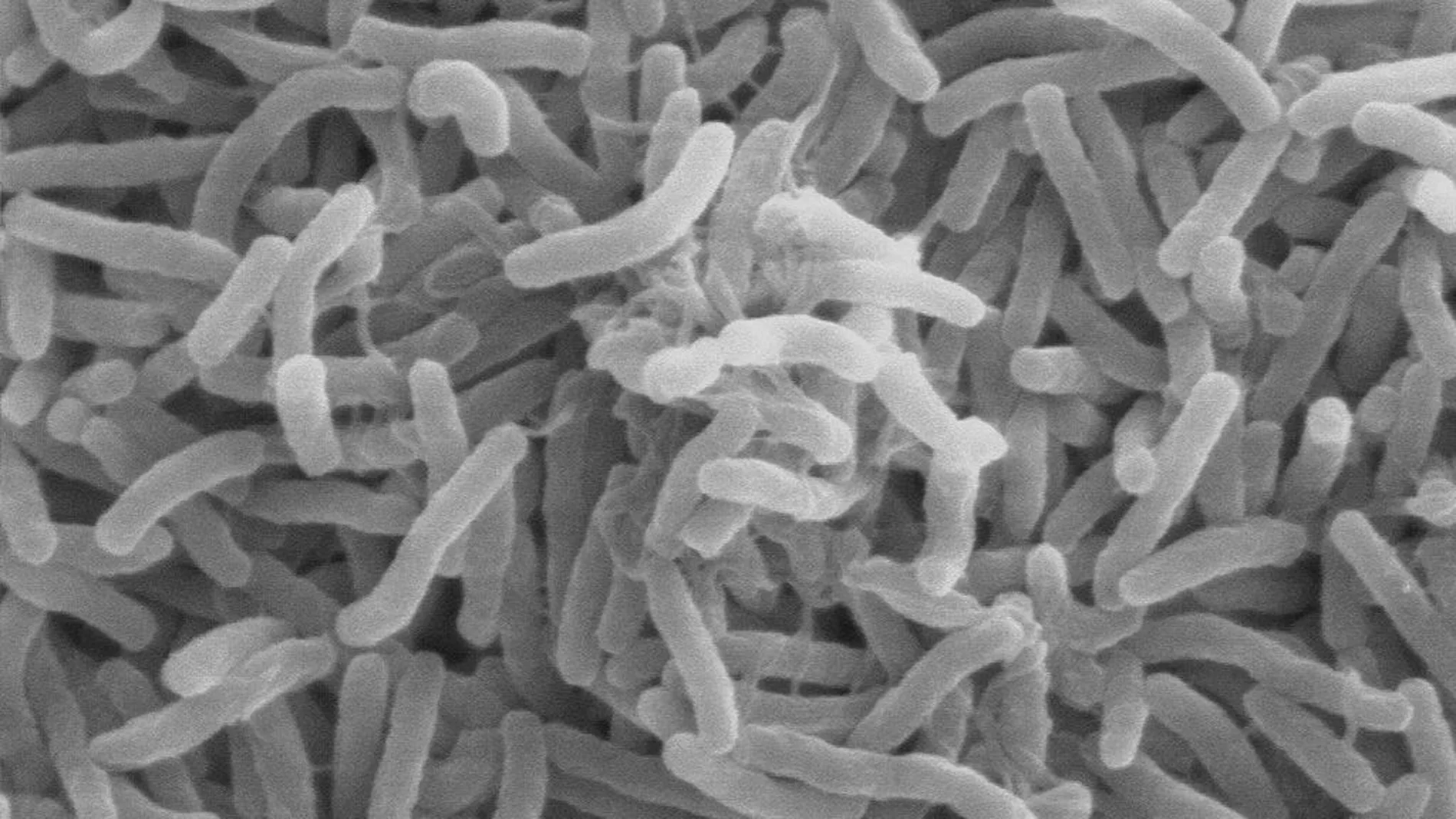 Vibrio cholerae: la bacteria que causa el cólera