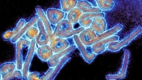 Virus de Marburgo