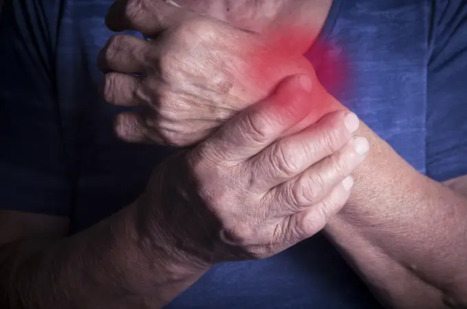 Encuentran un nuevo tratamiento para revertir la inflamación en la artritis reumatoide