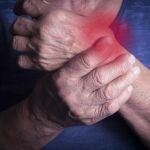 Artritis reumatoide
