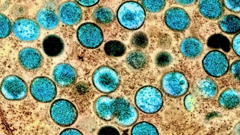 Virus de mpox visto en el microscopio