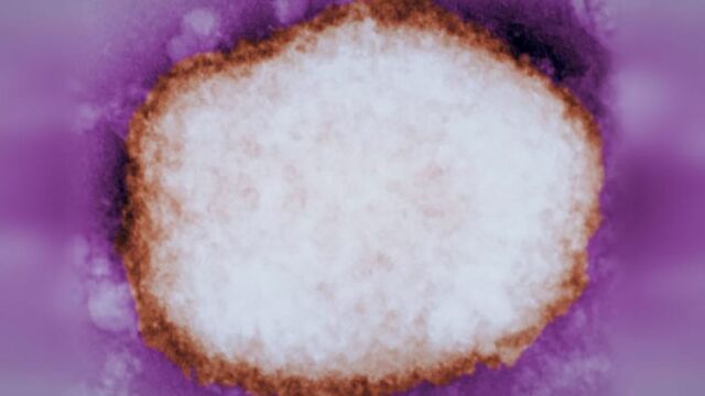 Partícula amplificada del virus de la viruela del mono