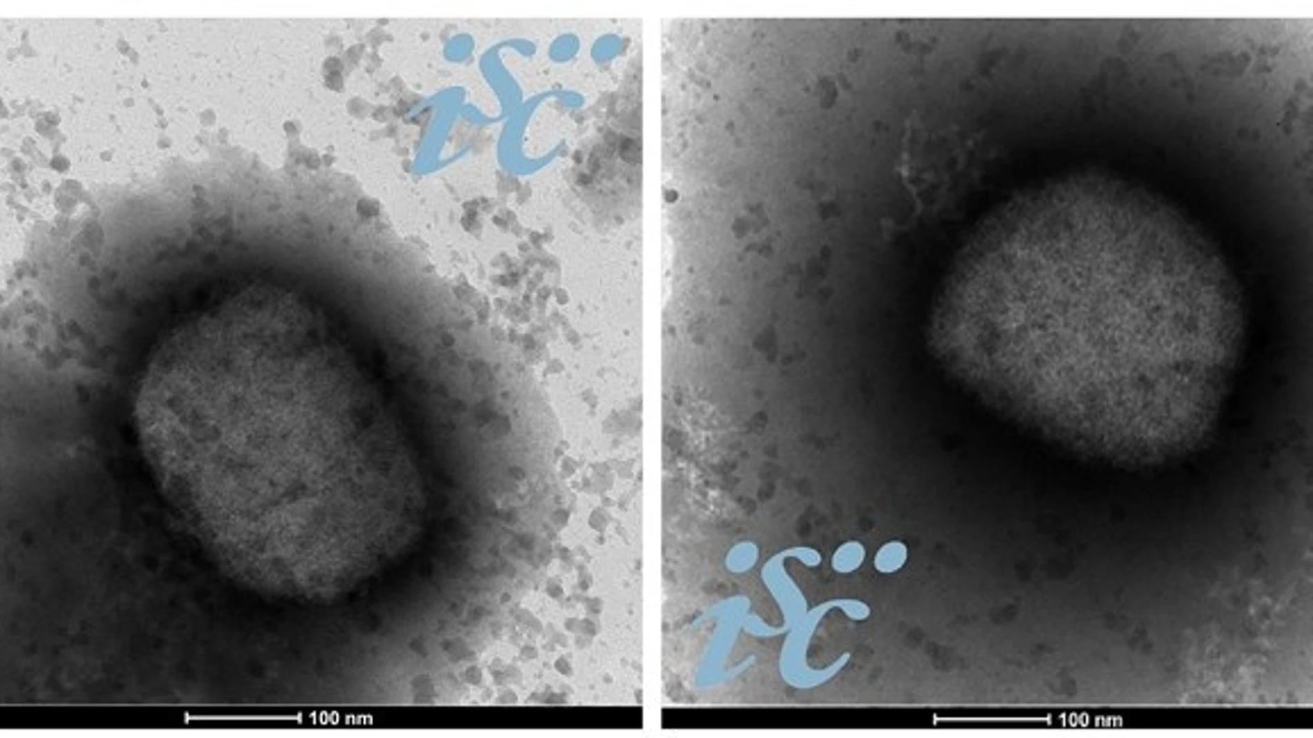 Dos imágenes, obtenidas por microscopía electrónica, del virus de la viruela del mono. Imagen: Unidad de Microscopía Electrónica del ISCIII