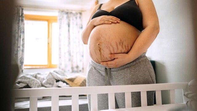 Las estrías y la celulitis son las grandes temidas durante el embarazo, a pesar de ser procesos totalmente naturales | Fuente: ObjetivoBienestar