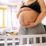 Las estrías y la celulitis son las grandes temidas durante el embarazo, a pesar de ser procesos totalmente naturales | Fuente: ObjetivoBienestar