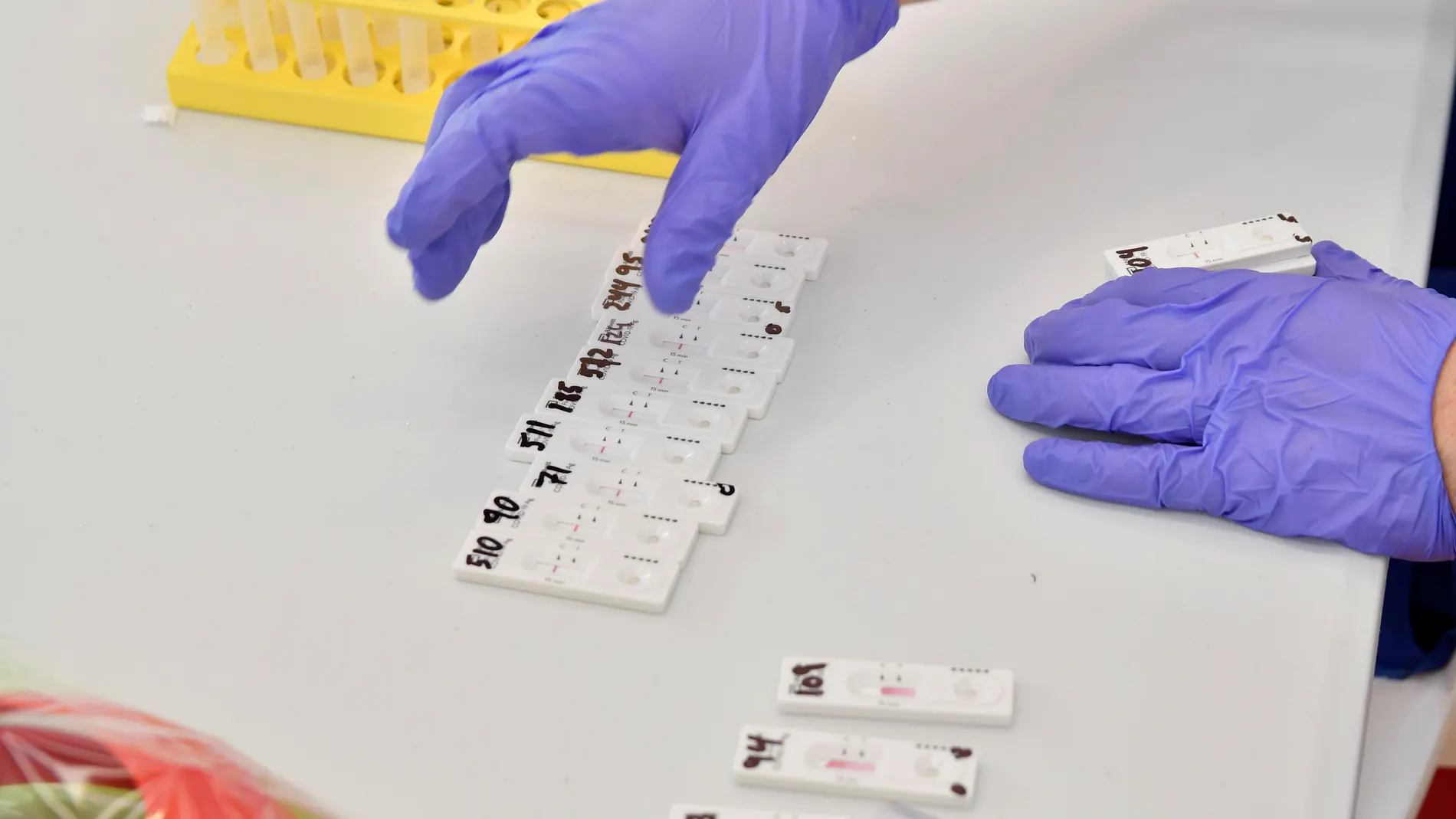El Gobierno madrileño invierte 22,5 millones de euros en comprar tests de antígenos