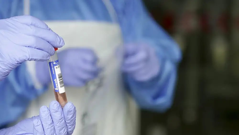 En la imagen se muestra una prueba PCR de detección del coronavirus