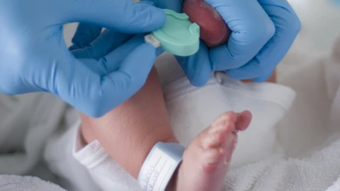 Prueba del talón a un bebé recién nacido