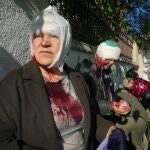 La capital ucraniana Kyiv, que estaba inmune a los bombardeos en los últimos meses, fue golpeada fuertemente por Rusia