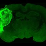 Cerebro de una rata donde se ha incorporado un organoide cerebral humano que brilla en un color más intenso gracias a la presencia de proteína verde fluorescente