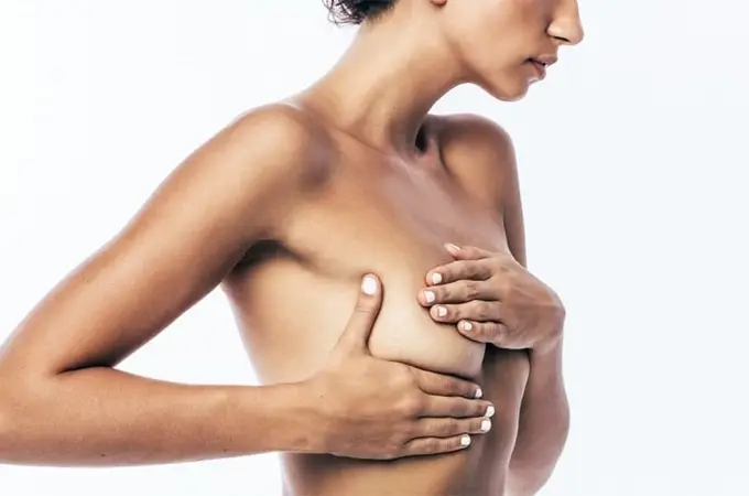 ¿Cuáles son los síntomas del cáncer de mama? 