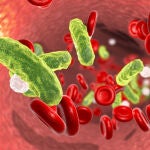 La septicemia es una infección producida por microorganismos patógenos en la sangre