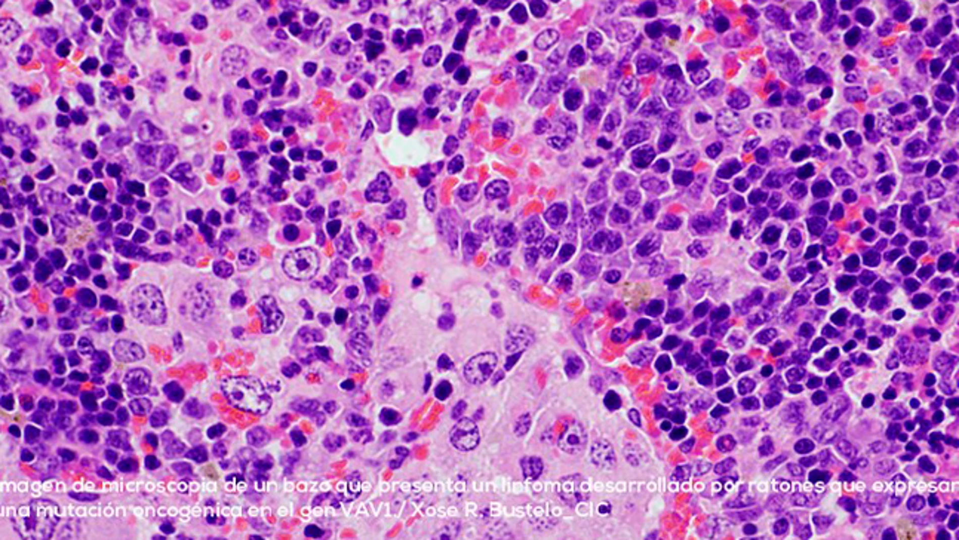 Nuevo trabajo de investigación de la Universidad de Salamanca en la lucha contra el cáncer