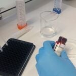 El test ha sido desarrollado por un equipo de la Universitat Politècnica de València, el Centro de Investigación Biomédica en Red de Bioingeniería, Biomateriales y Nanomedicina (CIBER-BBN) y el Instituto BAM de Berlín