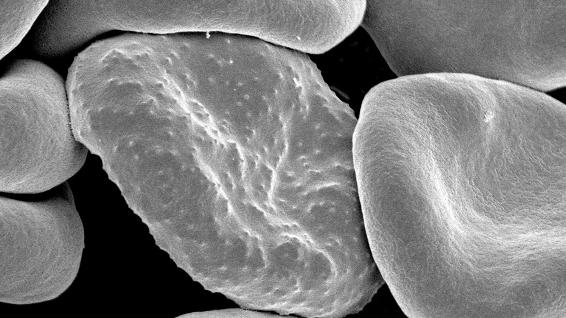 Glóbulos rojos infectados con malaria y “fotografiados” mediante un microscopio electrónico. (Rick Fairhurst and Jordan Zuspann, National Institute of Allergy and Infectious Diseases, National Institutes of Health)
