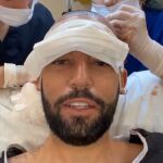 Omar Sánchez se somete a un injerto capilar en Turquía