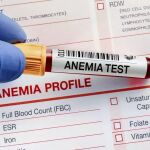 10 preguntas y respuestas sobre la anemia