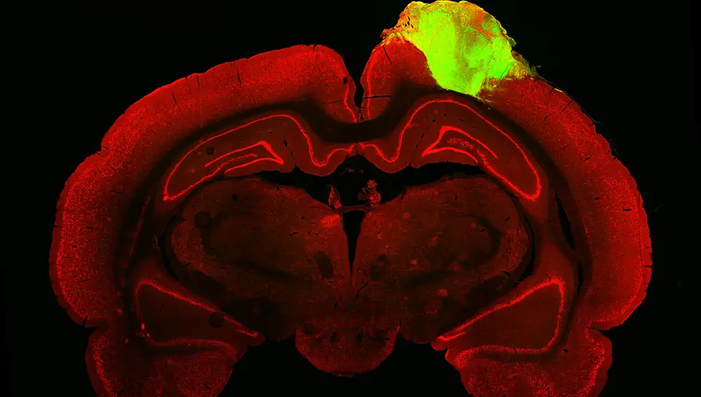 Imagen histológica de un cerebro de rata con un organoide cerebral humano injertado.