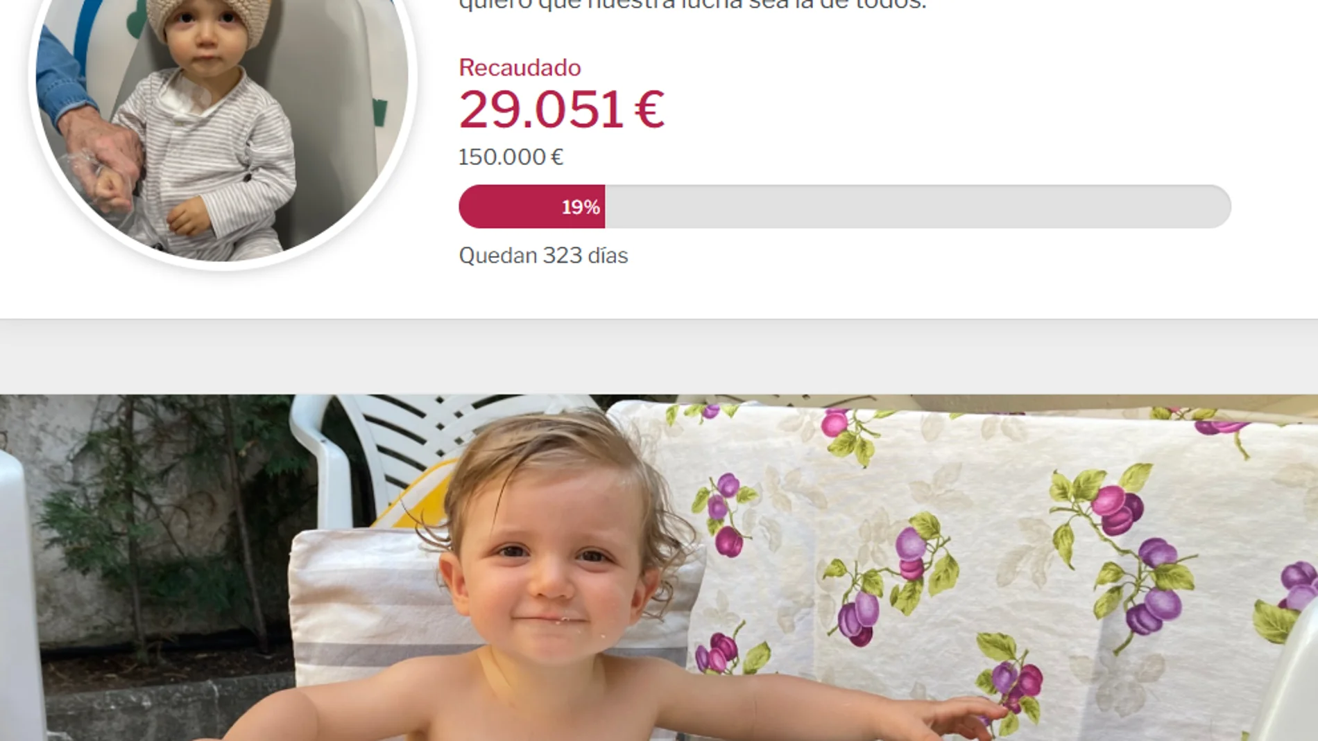 Ya se han recaudado 29.000 de los 150.000 euros que se necesitan