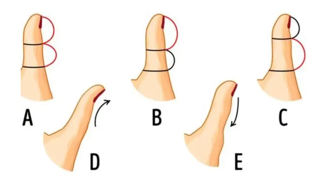 Elige el dibujo que más se parezca a la forma de tu pulgar