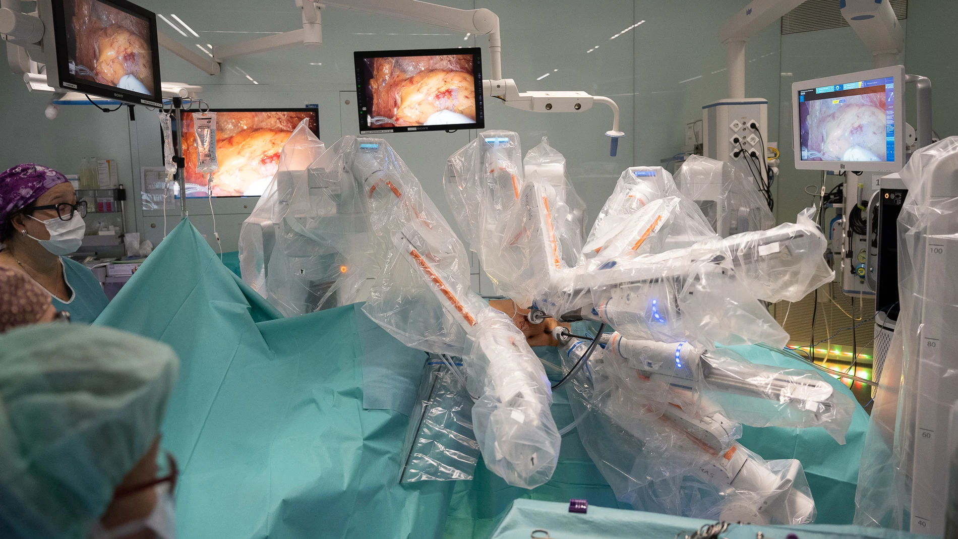 El Hospital Clínic de Barcelona usa el robot Hugo para las cirugías de urología