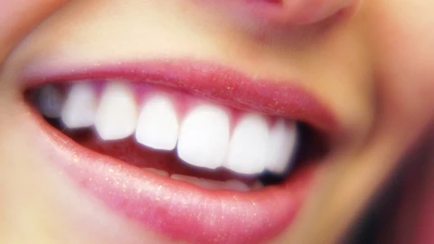 Yotuel pen, blanquea tus dientes y cabe en el bolso